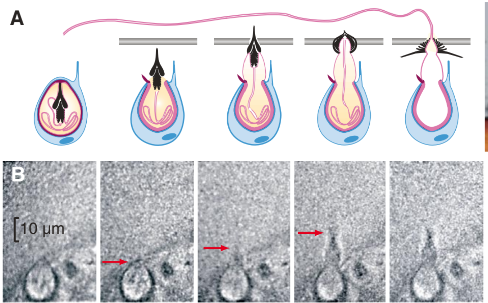 Nemacocyst discharge from Nuchter Fig 1